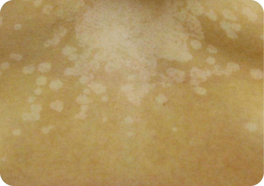 This table displays by row the percentage of grade 3 and higher toxicities per each of the arms of the BEACON-CRC trial, namely, the triplet-arm, the doublet-arm, and the control arm.