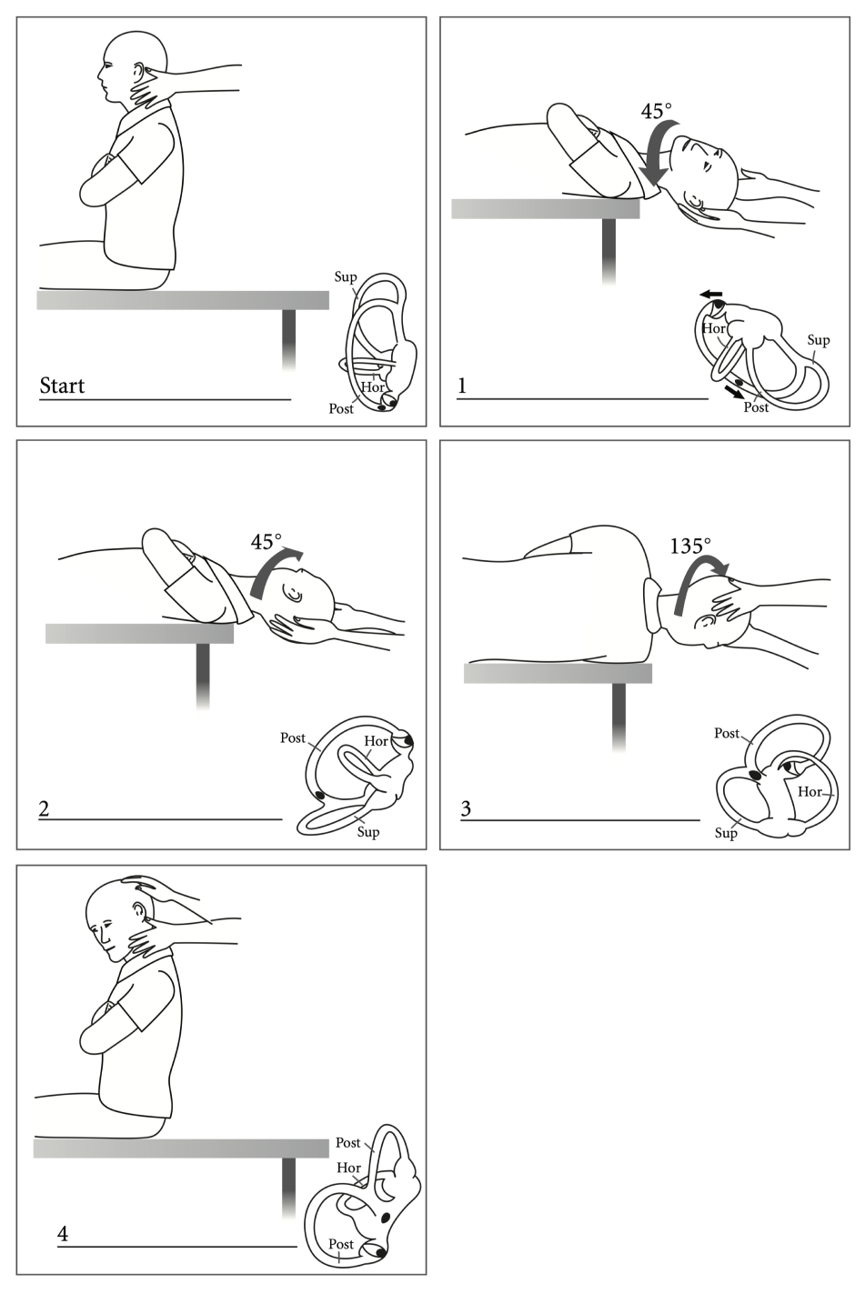 Causes of Dizziness